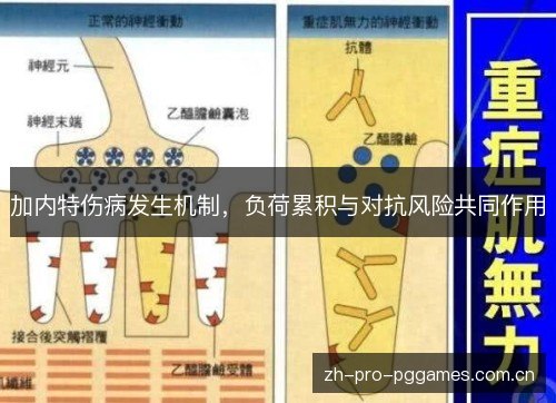 加内特伤病发生机制,负荷累积与对抗风险共同作用 加内特伤病发生机制,负荷累积与对抗风险共同作用
